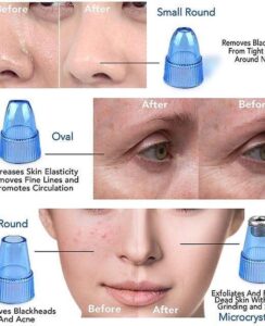 derma suction facial cleanser