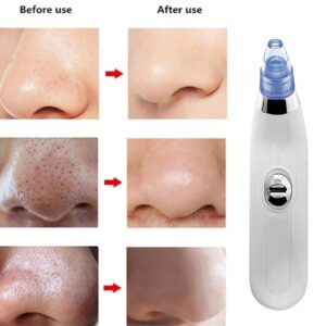 derma suction facial cleanser